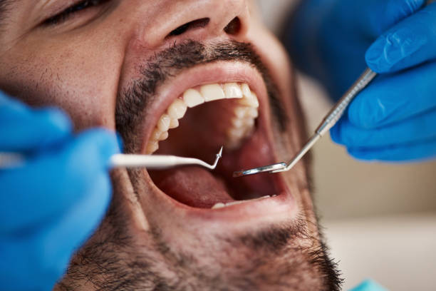 Best Dental Fillings (Composite and Amalgam)  in Hidalgo, TX